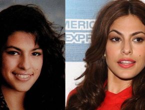 Eva Mendes before and after plastic surgery