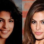 Eva Mendes before and after plastic surgery (11)