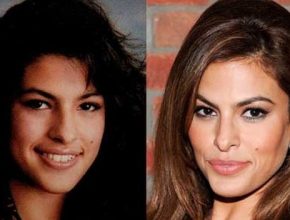 Eva Mendes before and after plastic surgery (11)