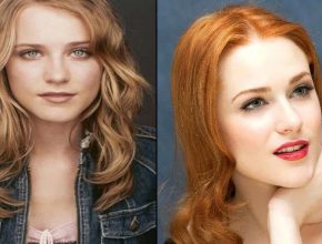 Evan Rachel Wood before and after plastic surgery
