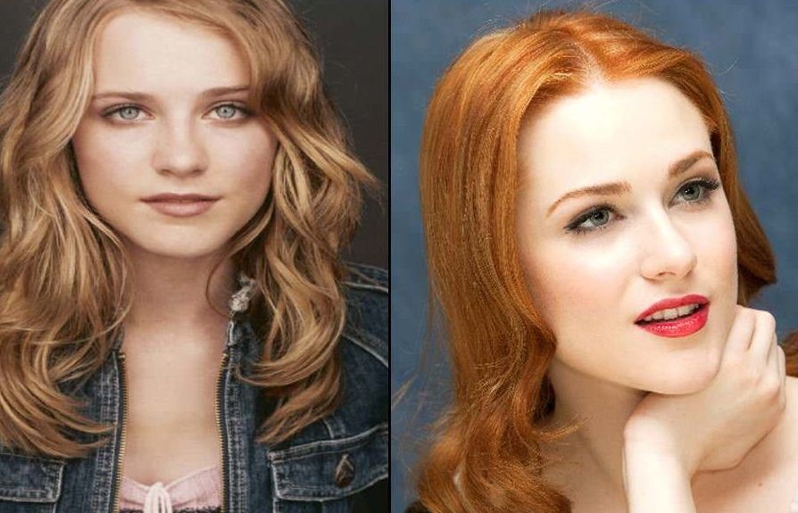 Evan Rachel Wood before and after plastic surgery