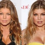 Fergie before and after plastic surgery (20)