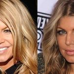 Fergie before and after plastic surgery (6)