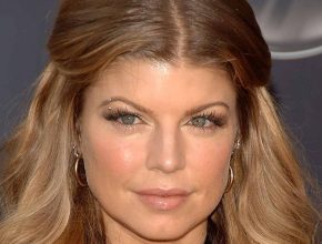 Fergie plastic surgery (19)