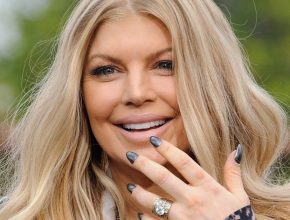 Fergie plastic surgery (30)