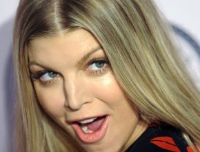 Fergie plastic surgery (51)