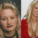 Holly Madison before and after plastic surgery (4)