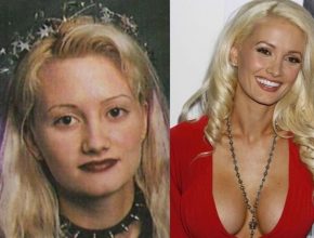Holly Madison before and after plastic surgery (4)