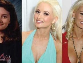 Holly Madison before and after plastic surgery (5)