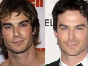 Ian Somerhalder before and after plastic surgery (10)