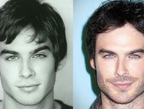 Ian Somerhalder before and after plastic surgery (21)