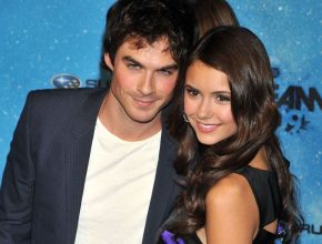 Ian Somerhalder plastic surgery (3) with Nina Dobrev