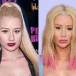 Iggy Azalea before and after plastic surgery (20)