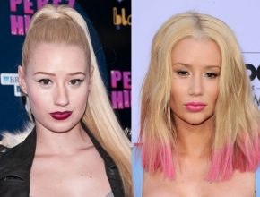 Iggy Azalea before and after plastic surgery (20)