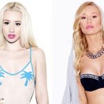 Iggy Azalea before and after plastic surgery (22)