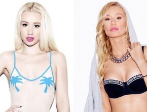 Iggy Azalea before and after plastic surgery (22)