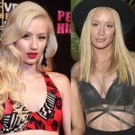 Iggy Azalea before and after plastic surgery (27)