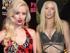 Iggy Azalea before and after plastic surgery (27)