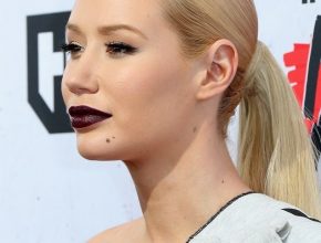 Iggy Azalea plastic surgery (13)