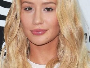 Iggy Azalea plastic surgery (3)