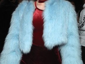 Iggy Azalea plastic surgery (31)