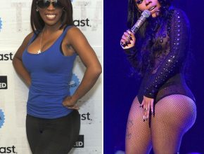 K. Michelle bifore and after plastic surgery