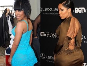 K. Michelle bifore and after plastic surgery