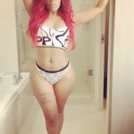 K. Michelle plastic surgery (12)