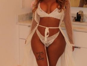 K. Michelle plastic surgery (17)