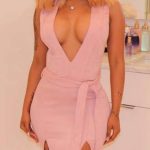 K. Michelle plastic surgery (25)