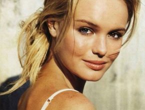 Kate Bosworth plastic surgery (20)