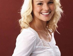 Kate Bosworth plastic surgery (21)