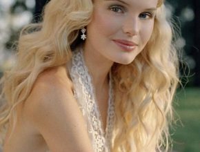 Kate Bosworth plastic surgery (42)
