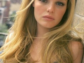 Kate Bosworth plastic surgery (43)