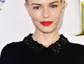 Kate Bosworth plastic surgery (45)