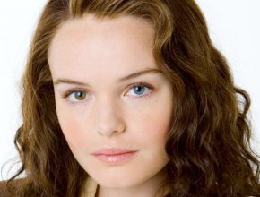 Kate Bosworth plastic surgery (48)