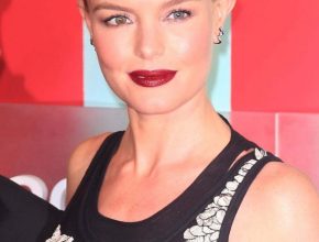 Kate Bosworth plastic surgery (9)