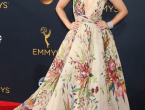 Kristen Bell plastic surgery (10)