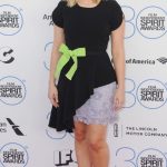 Kristen Bell plastic surgery (12)