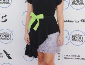 Kristen Bell plastic surgery (12)