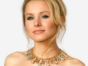Kristen Bell plastic surgery (15)