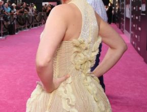 Kristen Bell plastic surgery (24)