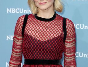 Kristen Bell plastic surgery (30)