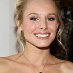 Kristen Bell plastic surgery (8)