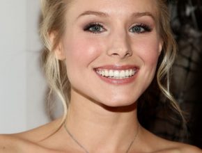 Kristen Bell plastic surgery (8)