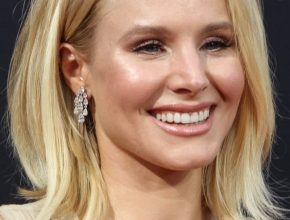 Kristen Bell plastic surgery (9)