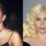 Lady Gaga before and after plastic surgery (21)