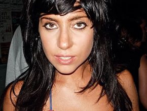 Lady Gaga before plastic surgery (43)