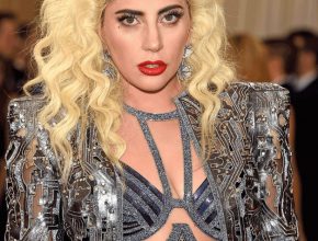 Lady Gaga plastic surgery (01)