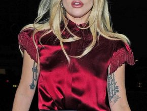 Lady Gaga plastic surgery (16)